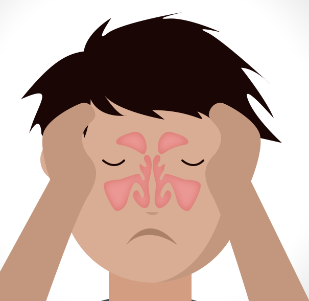 sinusitis-thumb
