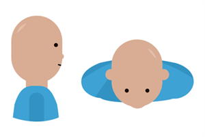 Hairloss -2 Diffus