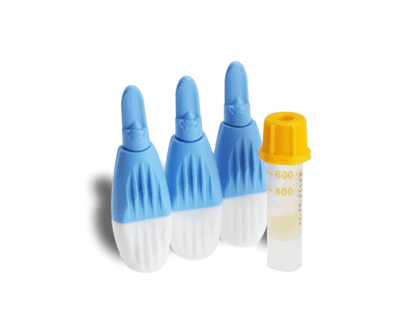 COVID-19 test anticuerpos COVID-19 test anticuerpos